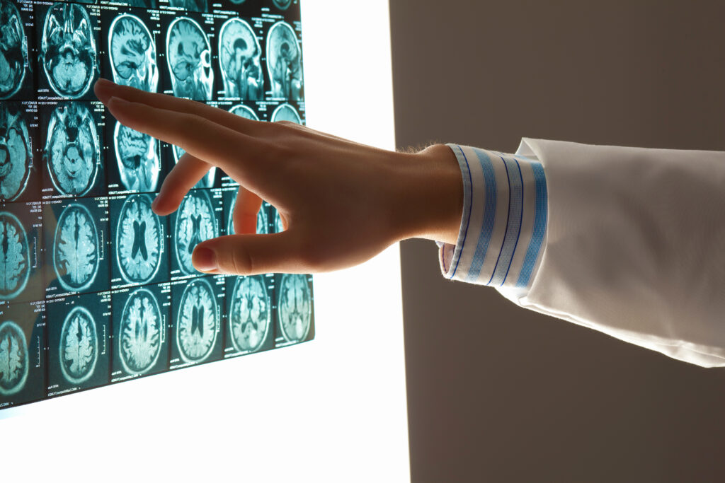 The Role of Expert Witnesses in Brain Injury Cases in South Carolina